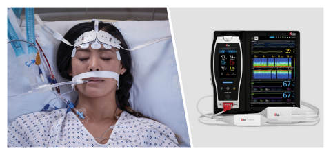 original Masimo Root® with O3® Regional Oximetry and SedLine® Brain Function Monitoring (Graphic: Business Wire)