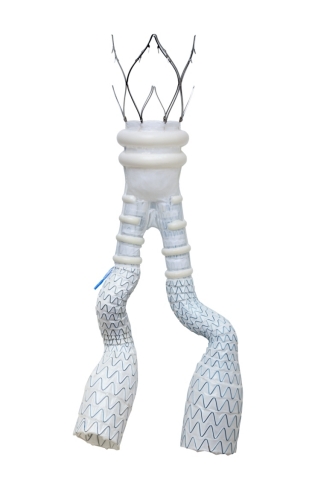 Featuring a unique, patented, sealing technology, the ALTO Abdominal Stent Graft System is the latest generation in polymer-based therapies for AAA patients. ALTO utilizes a low-profile delivery system and, unlike standard EVAR devices, features an exclusive conformable sealing ring that molds in-situ to the patient’s specific aortic neck anatomy. (Photo: Business Wire)