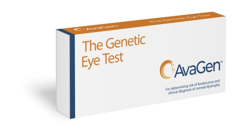 AvaGen is the first genetic test that helps determine a patient’s risk of keratoconus and the presence of other corneal dystrophies. (Photo: Business Wire)