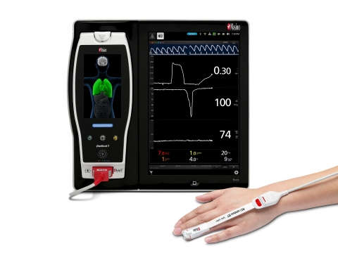 original Masimo Root® with ORi™ (Photo: Business Wire)