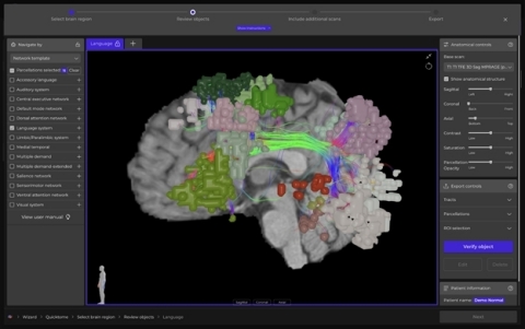 Quicktome allows neurosurgeons to visualize important brain networks, such as the language network, prior to surgery. (Photo: Business Wire)