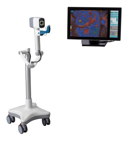 DYSIS View | Computer-Aided Colposcopy with Cervical Mapping (Photo: Business Wire)