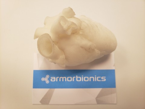 3D printed infant heart model manufactured for Armor Bionics by Shapeways transforms surgical pre-planning. (Photo: Business Wire)