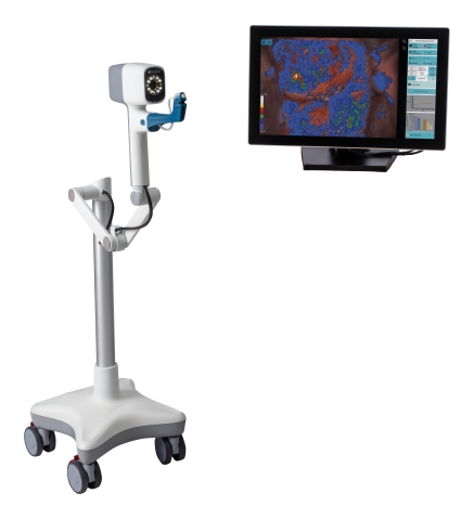 original DYSIS View | Computer-Aided Colposcopy with Cervical Mapping (Photo: Business Wire)