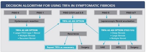 Decision Algorithm for Using TRFA in Symptomatic Fibroids (Graphic: Business Wire)