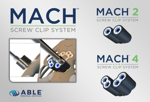 The MACH™ Screw Clip System is a single-use, sterile screw delivery system that does not require reprocessing or sterilization. By clipping directly onto the Valkyrie™ Thoracic Fixation System, the MACH Screw Clip delivers screws extremely fast and accurately for thoracic fixation. (Graphic: Business Wire)