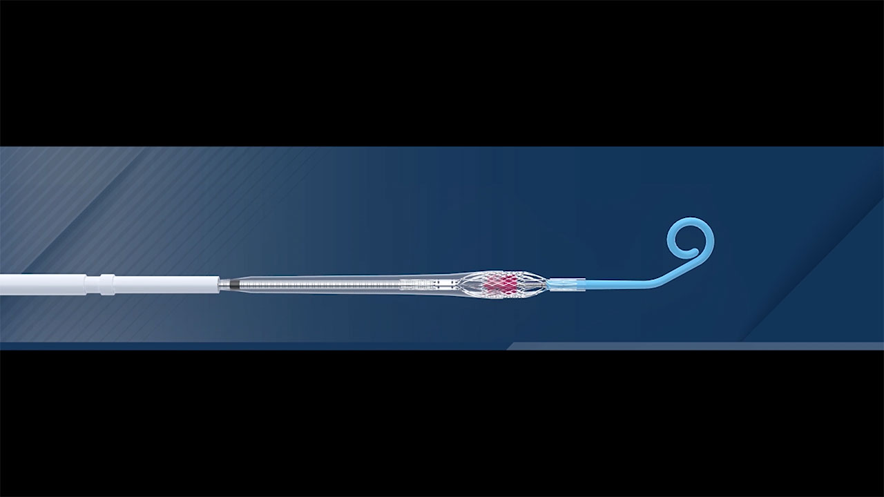 This animation shows Impella ECP, the world's smallest heart pump.  Impella ECP is placed percutaneously into the heart's left ventricle, expands, and supports the heart’s pumping function, providing flow greater than 3.5 L/min.