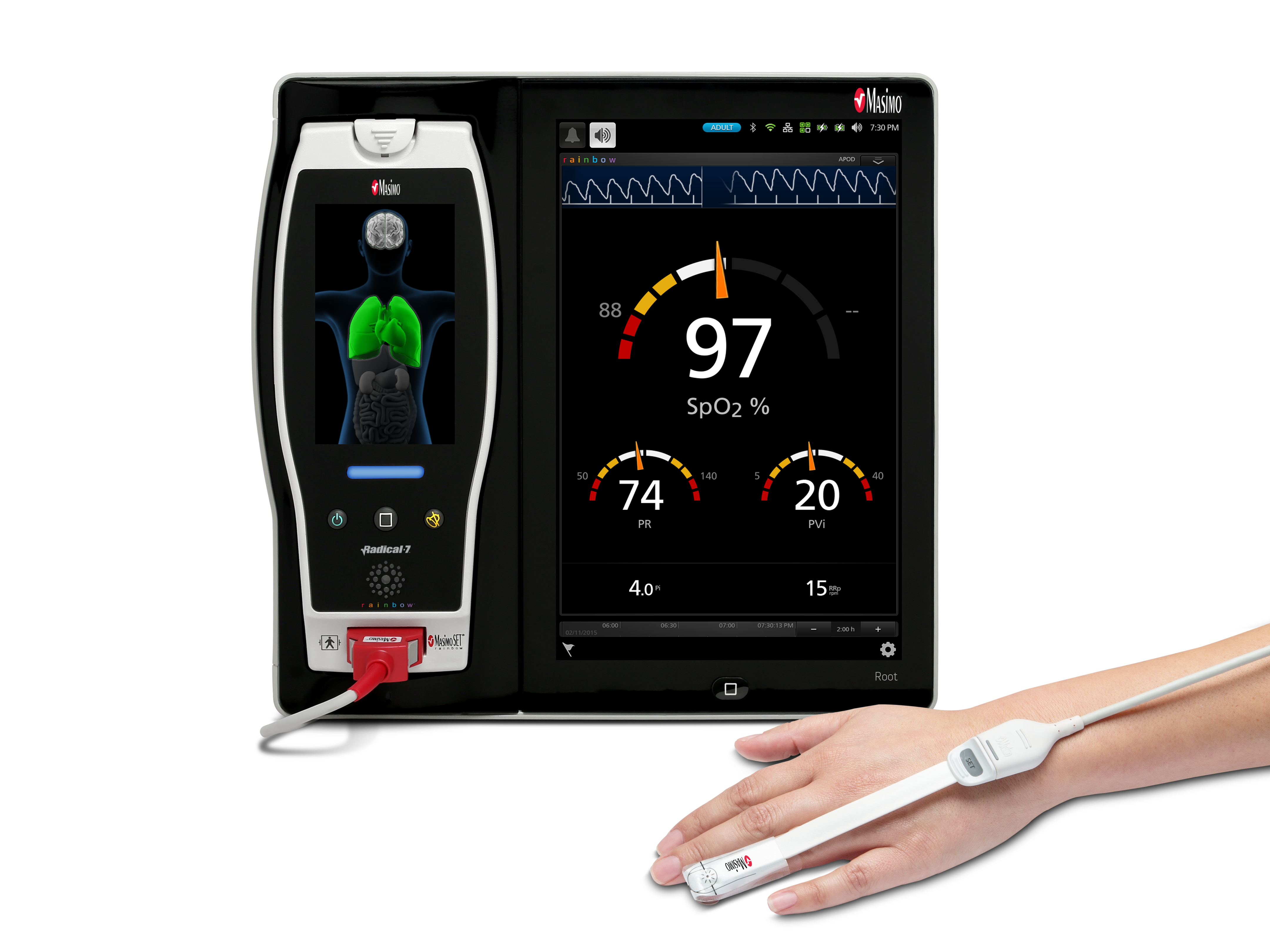 新研究对使用masimo Pvi 监护自主呼吸血液透析患者的血容量状态进行评估 Business Wire