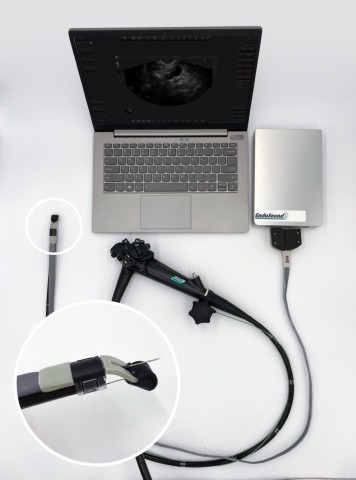 EndoSound Vision System mounted onto conventional video gastroscope. (Photo: Business Wire)