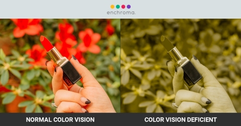 Normal Color Vision and Color Vision Deficient Views (Graphic: Business Wire)