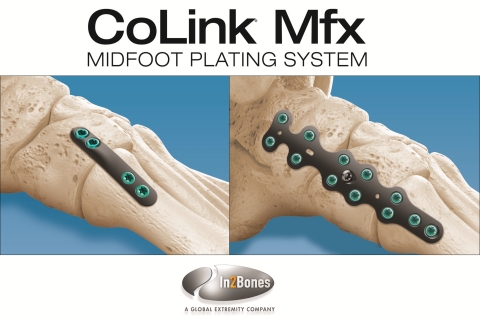 The CoLink Mfx Midfoot Plating System from In2Bones Global simplifies and speeds surgery of the midfoot and helps improve patient outcomes. Among the innovative design elements of the new System: low-profile titanium plates; anatomic contours; unique dorsal to plantar twist from the proximal to distal screw holes, allowing placement of an additional homerun screw (Lisfranc Plate); transverse compression hole for compression screw; Type II anodization finish for strength and smoothness; and full instrumentation – all in a pre-sterilized, OR-ready package. (Graphic: Business Wire)
