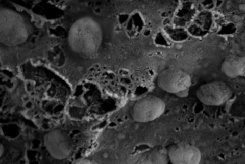 A high-powered microscope image showing exosomes, nanosized parts of cells. (Credit: Surya Shrivastava / City of Hope)