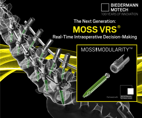 The Next Generation: MOSS VRS. Real-Time Intraoperative Decision Making. (Graphic: Business Wire)