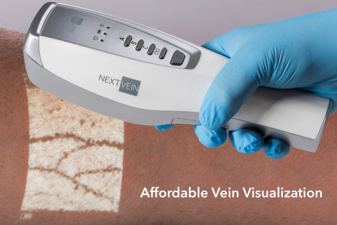 NextVein is the first meaningful alternative to expensive vein visualization systems. It offers the core features expected from hand-held vein visualization and adds advanced features like multicolor augmented reality projection.
As a hand-held device, the clinician can quickly assess the patient to identify veins. It converts to hands-free with the NextVein wheeled stand, freeing both hands for the procedure. This state-of-the-art stand provides a reliable, long-reach solution for procedures and doubles as storage while re-charging. (Photo: Business Wire)