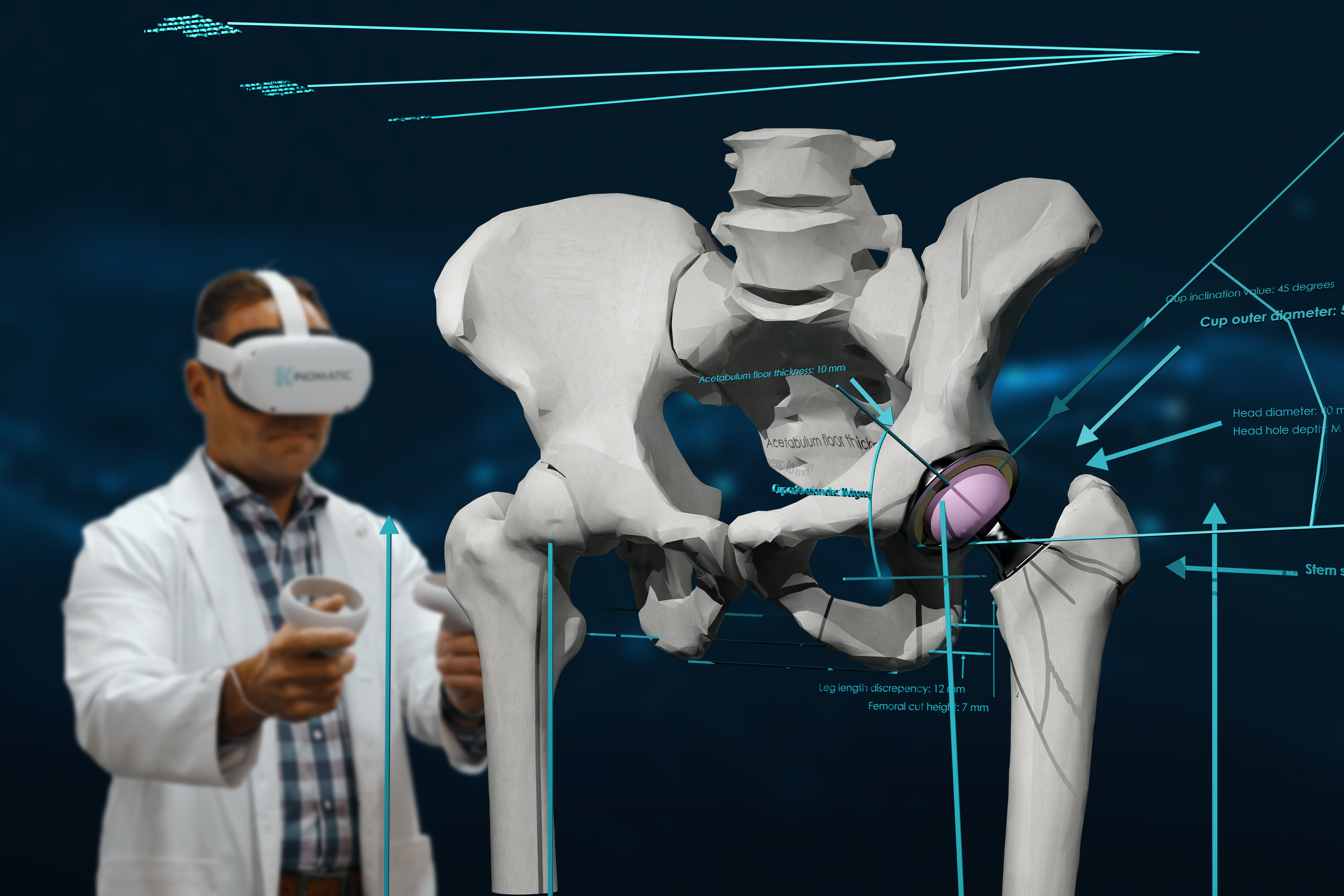 Kinomatic Is Giving Orthopedic Surgeons the Ability to Develop Custom  Surgical Plans in Virtual Reality | Business Wire