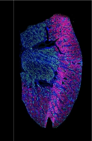 This kidney image represents a 5 µm FFPE tissue section from a 41-year-old man. The sample was visualized with PanCK (epithelial cells), CD10+CD31 (proximal convoluted tubules and endothelial cells), and SYTO 83 (nuclei). The sample was profiled on the GeoMx, using the Human Whole Transcriptome Atlas (WTA) assay. (Photo: Business Wire)