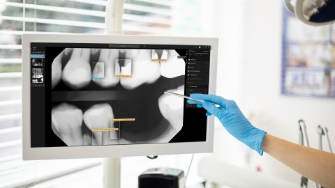 Pearl's Second Opinion® software is the first comprehensive AI-powered real-time pathology detection aid for dentists. (Photo: Business Wire)