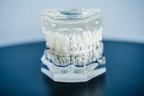 In the last year, LightForce has developed additional orthodontic advancements such as the Light Bracket, which is their line of translucent braces. The Light Bracket is a more aesthetic option that blends in with the color of a patient’s teeth, reducing the visibility of the overall system. (Photo: Business Wire)