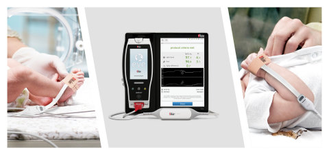 original Masimo Dual SET® Pulse Oximetry with Root® and Eve™ (Photo: Business Wire)