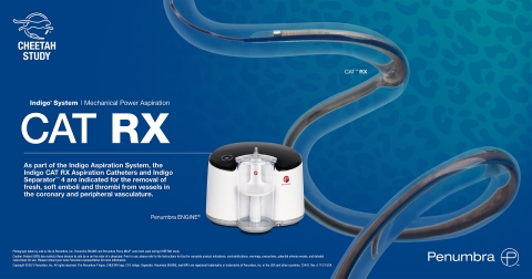 As part of the Indigo® Aspiration System, the Indigo CAT RX Aspiration Catheters and Indigo Separator™ 4 are indicated for the removal of fresh, soft emboli and thrombi from vessels in the coronary and peripheral vasculature. (Graphic: Business Wire)