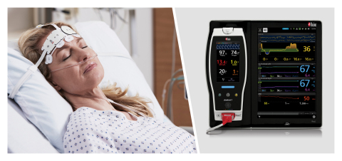 Masimo Root® with SedLine®, O3®, and ANI® (Photo: Business Wire)