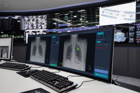 Lunit INSIGHT CXR, an AI-based chest X-ray analyzing solution of Lunit, enables medical professionals to detect 10 major chest diseases by reading X-ray images with an accuracy of over 97~99% in a few seconds. (Photo: Business Wire)