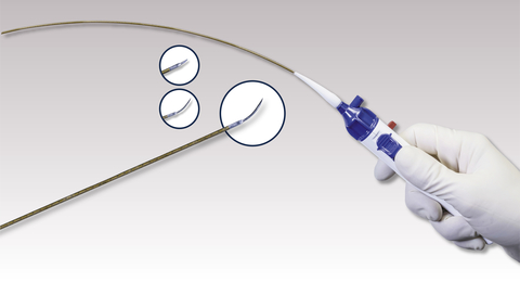 The GoBack Catheter is a single-lumen crossing catheter which features a curved nitinol needle that serves as an effective crossing tool. The versatile needle can be extended straight or to a curved position beyond the GoBack Catheter’s tip. The protrusion length is determined by the clinician with a thumb selector on the device’s handle. The GoBack comes in two configurations of 4 French and 2.9 French for above and below the knee procedures. The GoBack has regulatory approval in 30 countries. (Photo: Upstream Peripheral Technologies)