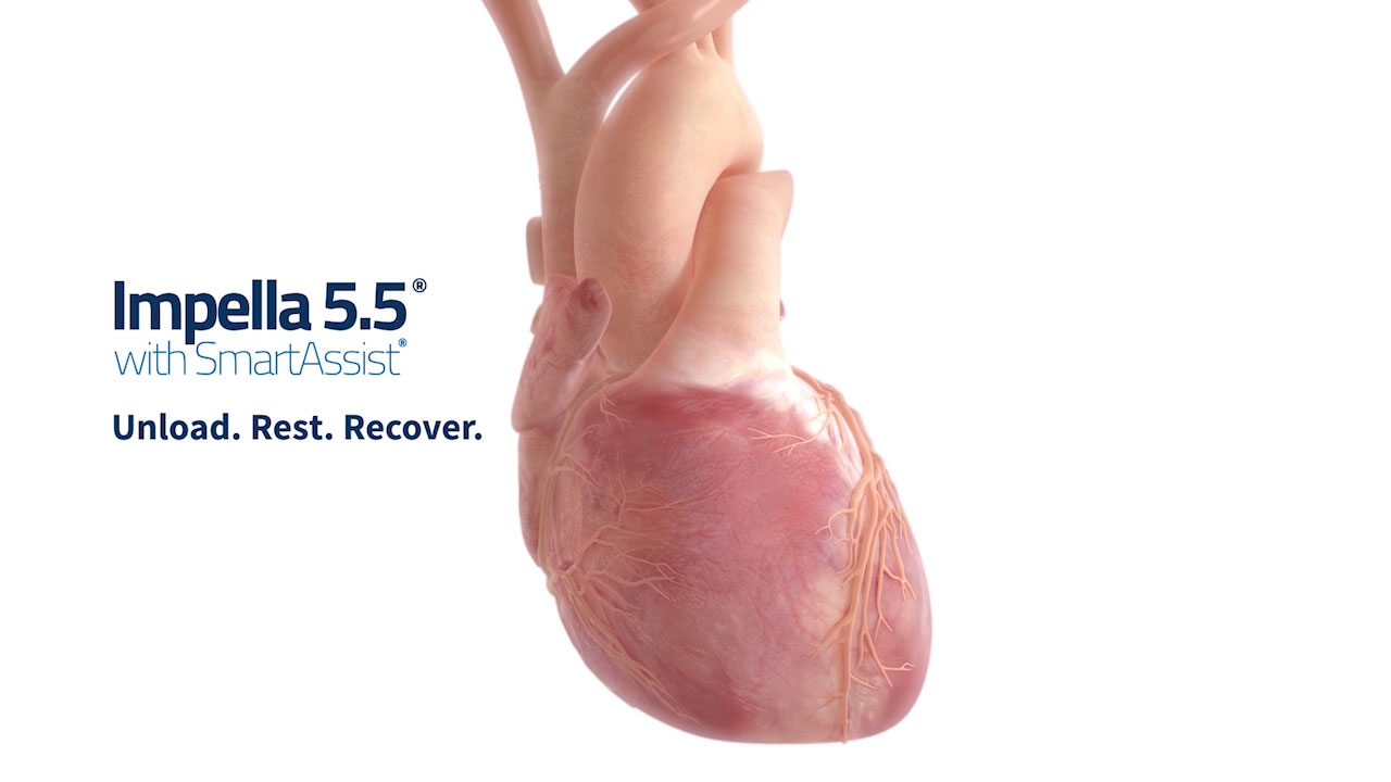 このアニメーションは、Impella 5.5 SmartAssistが心臓に留置され、心臓の負荷軽減、休息、回復をサポートする様子を示しています。.