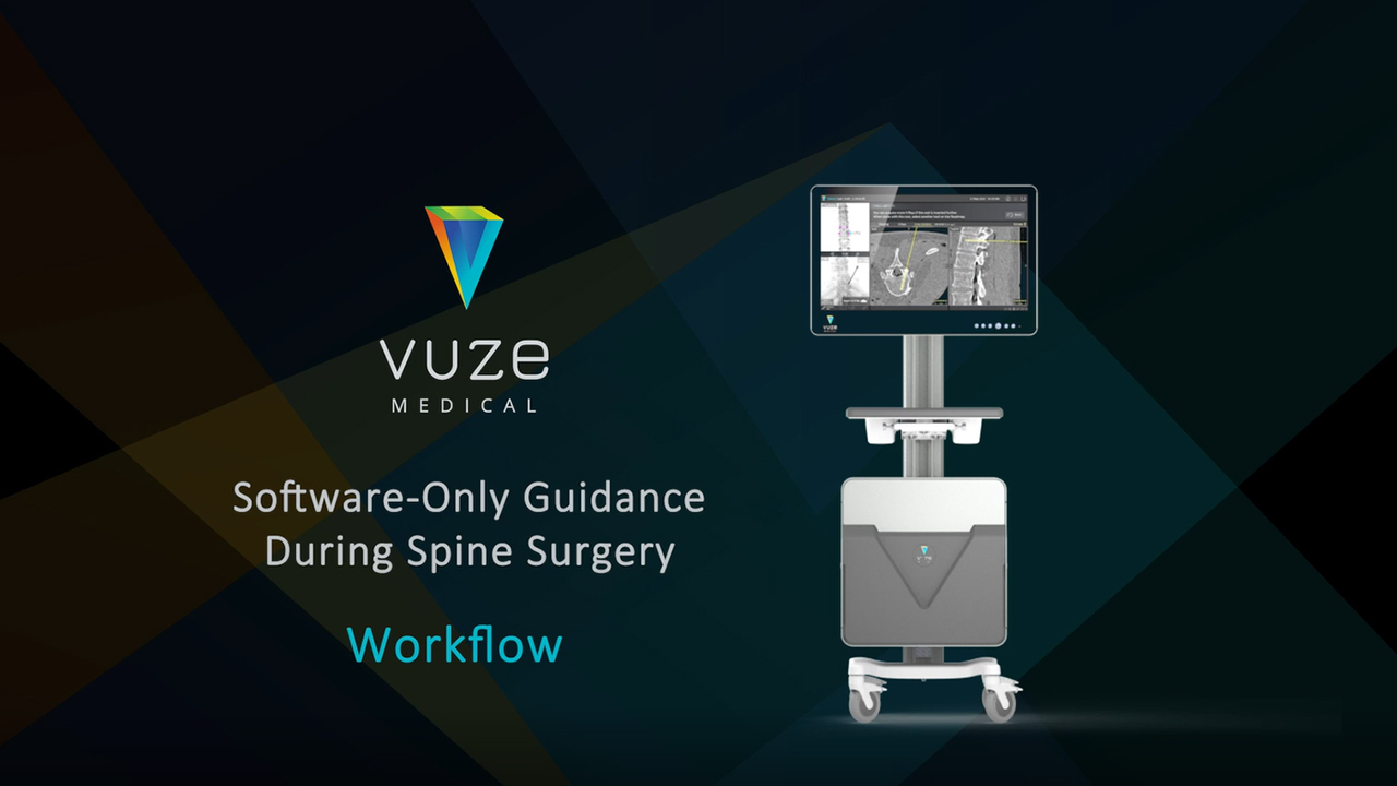 VUZE displays critical cross-sectional views that are currently unavailable during X-ray guided surgery. It overlays instantly the positions and trajectories of surgical tools seen in standard intra-operative 2D X-ray images onto cross sections generated from a standard pre-operative CT scan. Further facilitating this workflow, only top-view (AP) X-rays are required.