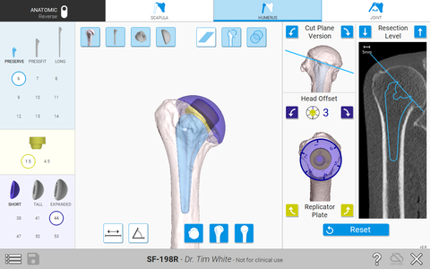 The Equinoxe Planning App (v.2.0) allows for humeral head offsets and replicator plate positioning. (Photo: Business Wire)