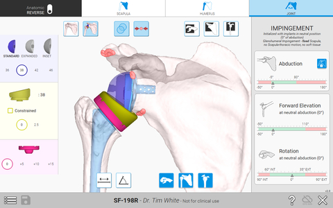 The Equinoxe Planning App (v.2.0) assists surgeons in assessing impingement and range of motion. (Photo: Business Wire)