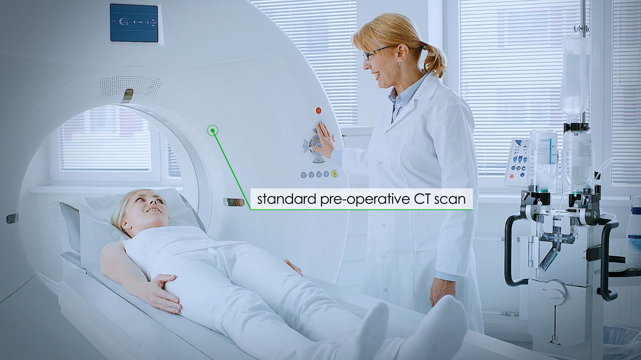 The VUZE System is a software-only solution that overlays a graphical representation of tools seen in intra-operative 2D images onto axial and sagittal views generated from the patient’s standard pre-operative 3D scan. The system is designed for use during common spinal surgeries that are performed in outpatient or ambulatory settings. Watch how it works in this video.