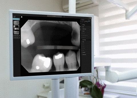 Second Opinion® features a clear, high-contrast user interface for optimal X-ray viewability.(Photo: Business Wire)
