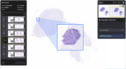 thumbnail Paige Breast Lymph Node is designed to increase the accuracy and efficiency in the detection of breast cancer metastases that are most at-risk for being missed. (Photo: Paige)