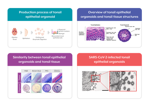 World’s-first tonsil epithelial organoids model for SARS-CoV-2 infection published in Biomaterials. The research team led by Professor Jongman Yoo (Cha University and CEO of ORGANOIDSCIENCES) along with Professor Young-Chang Lim (Konkuk University) and Dr. Meehyein Kim (Korea Research Institute of Chemical Technology) established tonsil epithelial cell-derived organoids and proved their feasibility as a 3D cultured infection model. (Graphic: Business Wire)