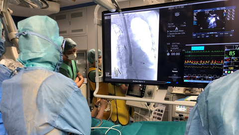 Surgeons at Osaka Police Hospital view a fluoroscopy image showing Impella 5.5 with SmartAssist pumping in the patient’s heart during the first procedure in Japan. (Photo: Business Wire)