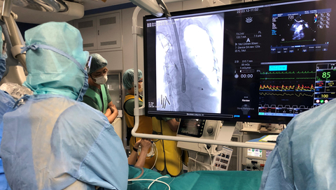 thumbnail Surgeons at Osaka Police Hospital view a fluoroscopy image showing Impella 5.5 with SmartAssist pumping in the patient’s heart during the first procedure in Japan. (Photo: Business Wire)