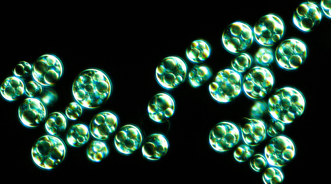A microscopic image shows the accumulation of large oil droplets forming within individual microalgae cells at Checkerspot laboratories. From an evolutionary perspective, algae evolved to produce oil as a matter of survival in the Earth’s most extreme environments. (Photo: Business Wire)