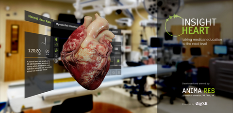 Insight Heart by ANIMA RES, powered by GigXR (Photo: Business Wire)