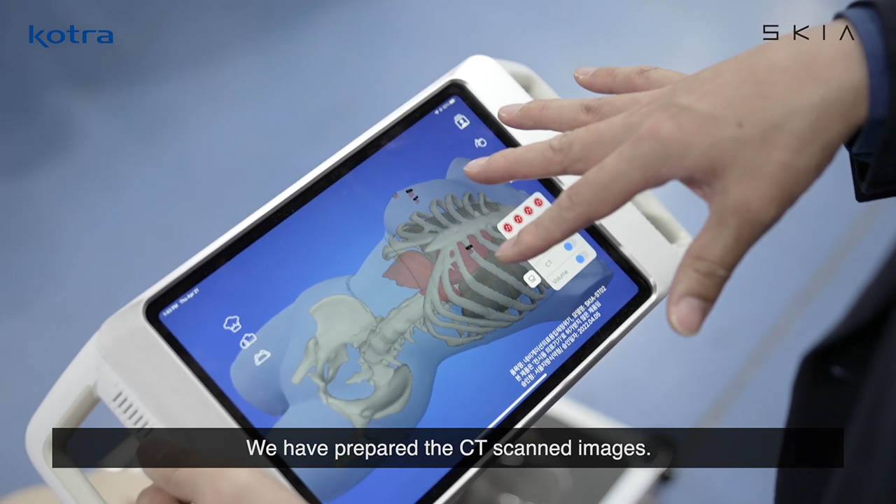 SKIA_Breast is a digital surgery guide solution based on augmented reality that superimposes a patient's medical images (like CT or MRI) with a real-time camera view of the surgeon. The surgeon can check the location or shape of tissue by examining an image which is projected onto the patient's skin.