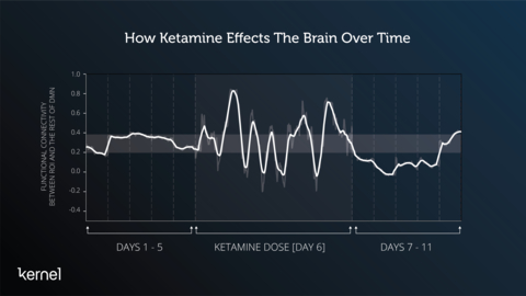 Johnson’s functional connectivity was stable for days 1-5 prior to Ketamine. His brain showed large changes during the Ketamine session. Post Ketamine, Johnson’s functional connectivity decreases for days and then begins trending to normalize back to his baseline, for a given Region of Interest (ROI) and Default Mode Network (DMN). (Graphic: Business Wire)