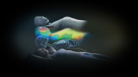 thumbnail CE-marked and FDA-cleared ExacTrac Dynamic enables the delivery of precision radiotherapy with surface and thermal tracking combined with real-time X-Ray monitoring. (Source: Brainlab)