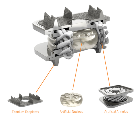 Cutaway image of the M6-C artificial cervical disc showing the unique nucleus-annulus design that mimics the natural structure of a native disc. (Photo: Business Wire)
