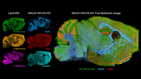 Images from a single fresh-frozen sagittal mouse brain section showing three representative lipids associated with neurological function, three of the 12plex targeted neurological proteins from the MALDI HiPLEX-IHC experiment on the same tissue section, and a true multiomic overlay of a representative lipid and two proteins. Images were rendered using the new multiomic module for SCiLS Lab 2023a. (Photo: Business Wire)