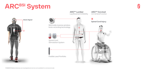 ONWARD ARC Brain Spine Interface (Graphic: Business Wire)