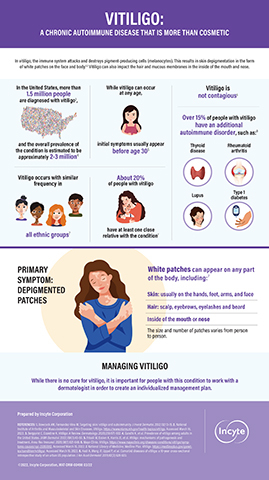 Informationen und statistische Angaben zu Vitiligo