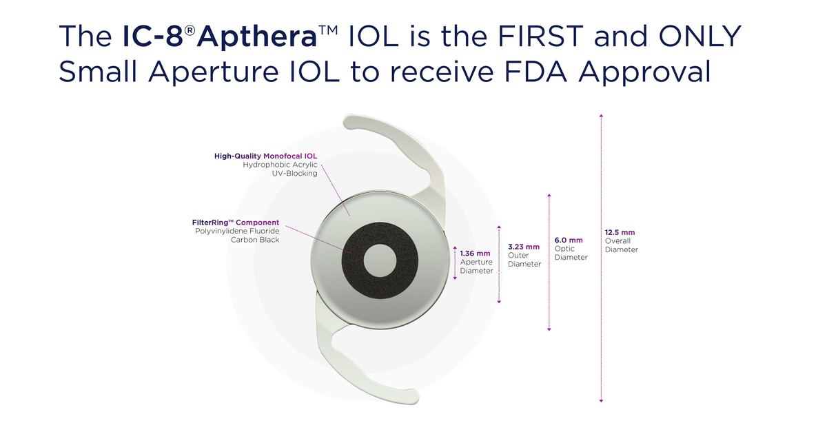 Acufocus Announces Fda Approval For The Ic 8® Apthera™ Intraocular Lens