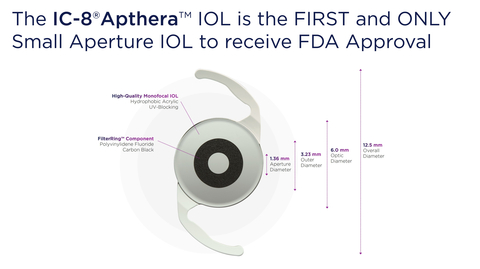 Apthera IOL Image (Graphic: Business Wire)