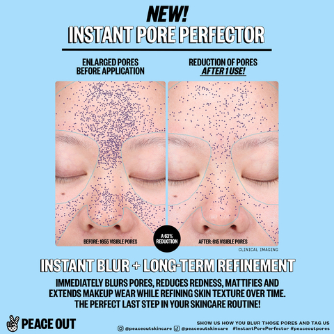 Peace Out Skincare Instant Pore Perfector (Clinical Imaging)