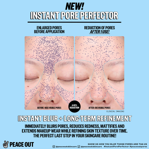 original Peace Out Skincare Instant Pore Perfector (Clinical Imaging)